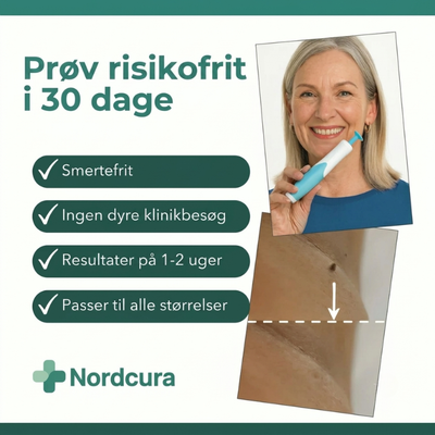 En kvinde holder en hudflis-fjerner med teksten »Prøv det risikofrit i 30 dage« og fire fordele: smertefrit, ingen klinikbesøg, resultat på 1–2 uger og passer til alle størrelser