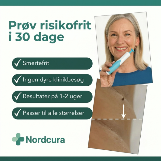 En kvinde holder en hudflis-fjerner med teksten »Prøv det risikofrit i 30 dage« og fire fordele: smertefrit, ingen klinikbesøg, resultat på 1–2 uger og passer til alle størrelser