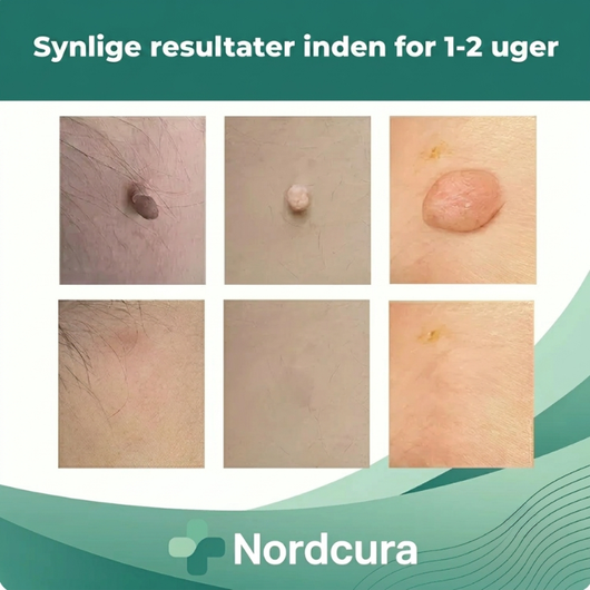 Før- og efterbilleder, der viser tre forskellige hudlapper på huden og de samme områder efter behandlingen, med teksten »Synlige resultater inden for 1–2 uger«
