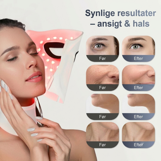 InfraRelief™ Ansigtsmaske 2.0 – Rødlysbehandling for bedre hudpleje